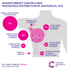 Breast Cancer Symptoms