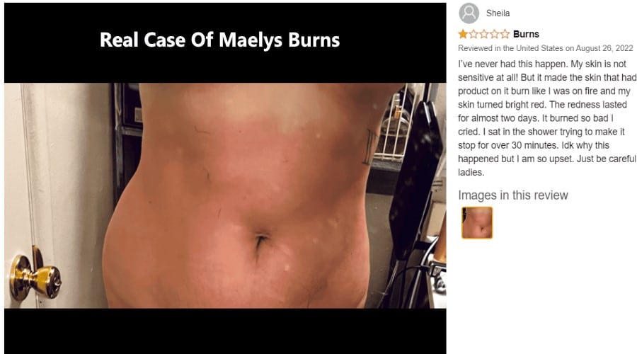 Maelys Burns Real Experience