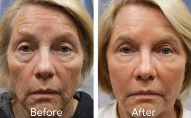 Knowledee Face Serum Before And After Results