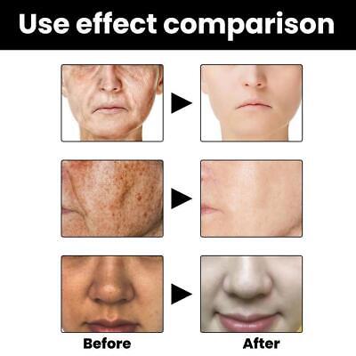 Foul Melanin Correcting Facial Serum Before & After