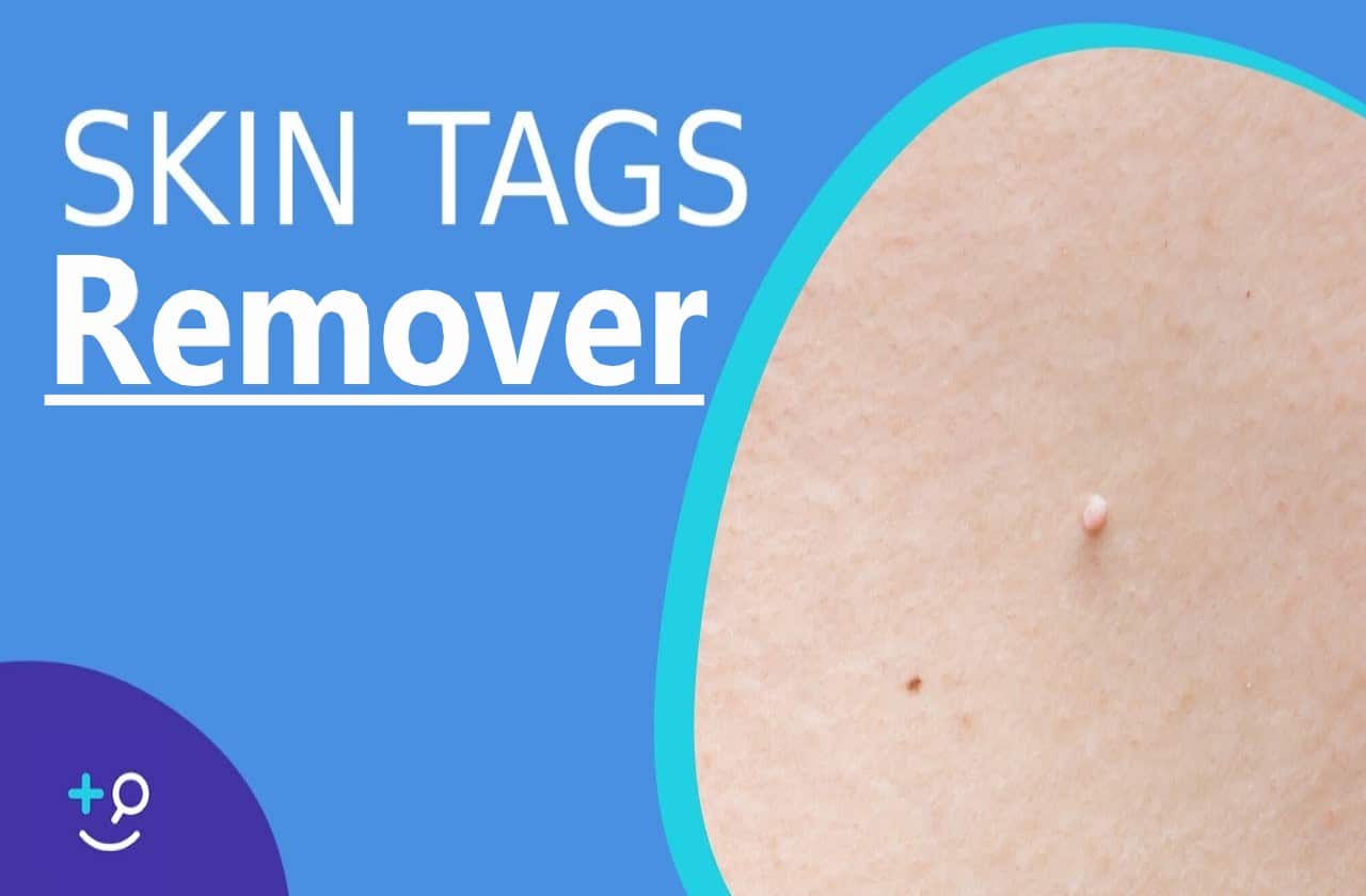 Carasskin Skin Tag Remover