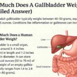 How Much Does A Gallbladder Weigh?