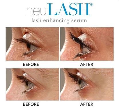 NeuLash Before And After