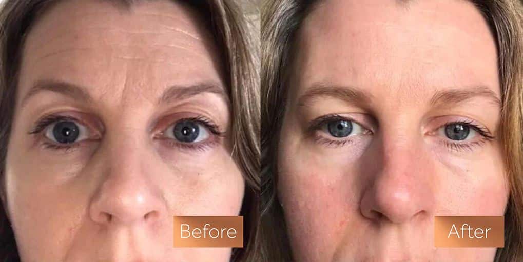 Tru Alchemy Eye Elixir Before and After