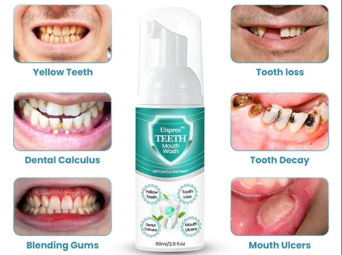 Unpree Teeth Mouthwash